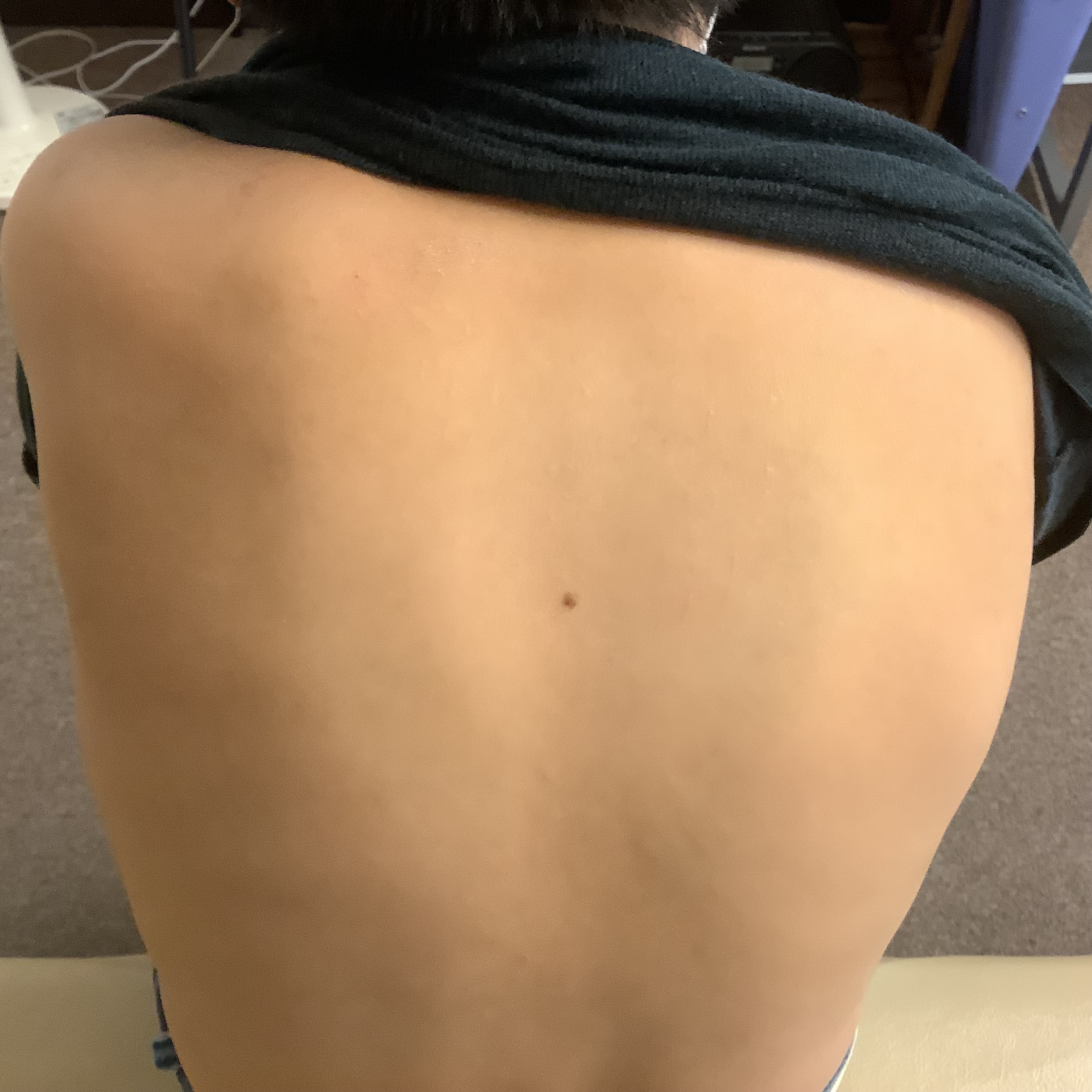 仙台　整体院　アトピー　あおば整体院