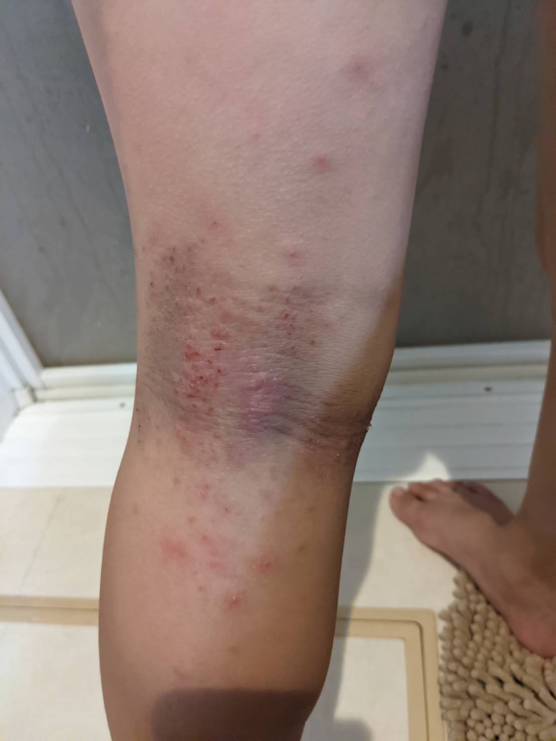 仙台　整体院　アトピー　あおば整体院