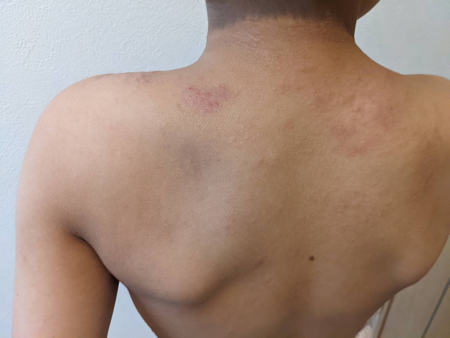 仙台　整体院　アトピー　あおば整体院